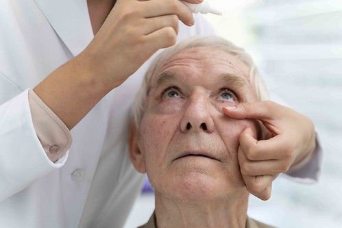 Degeneración Macular Asociada a la Edad, ¿es grave? Degeneración Macular Asociada a la Edad, ¿es grave?