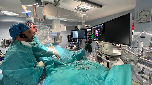 Quirónsalud Sagrado Corazón refuerza su Unidad de Arritmias con la ablación por campo pulsado, una innovadora técnica para tratar la fibrilación auricular Quirónsalud Sagrado Corazón refuerza su Unidad de Arritmias con la ablación por campo pulsado, una innovadora técnica para tratar la fibrilación auricular